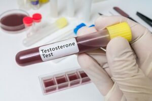 Segurança cardiovascular da terapia de reposição com testosterona